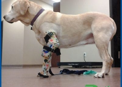 Prosthetics